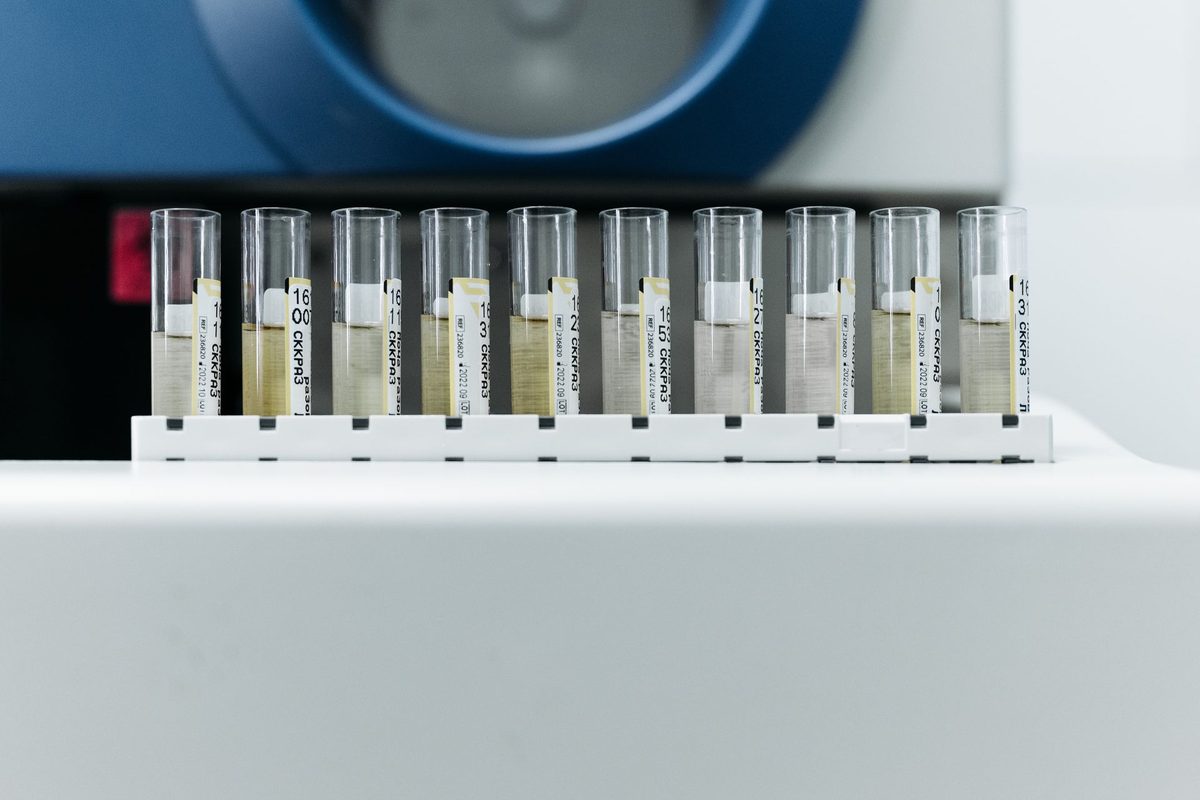 Labeled sample tubes ready for shipment